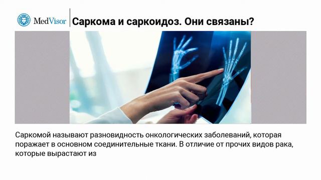 Почему путают саркому и саркоидоз, и как они связаны? смотреть онлайн