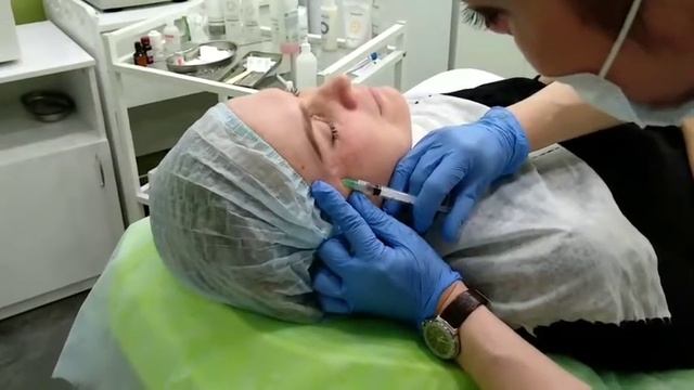 Биоревитализация вокруг глаз. Клиника косметологии 