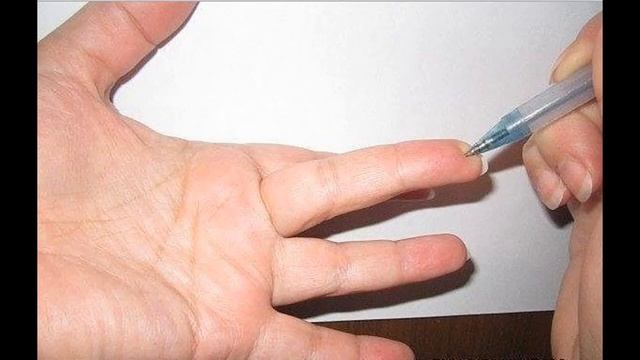 Особая лечебная точка на пальце смотреть онлайн