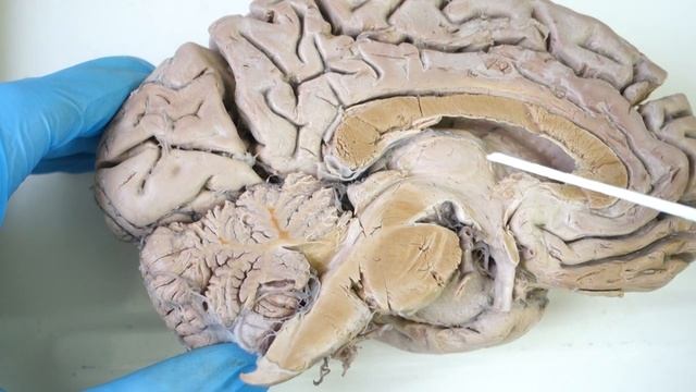 Отделы головного мозга