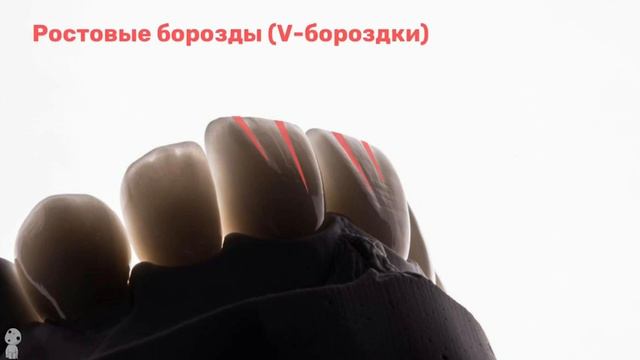 Морфология верхних резцов | CARVIDENT смотреть онлайн