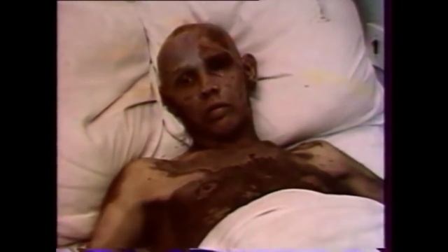 Chernobyl: Radiation effects of RBMK explosion смотреть онлайн