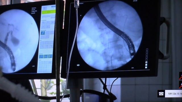 Endoscop Часть 2 смотреть онлайн