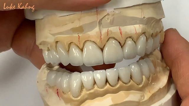 How to create a 23-Unit Hollywood Smile смотреть онлайн