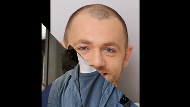 Обгорел на съемочной площадке...Горе пришло в дом актера Дениса Шведова... смотреть онлайн