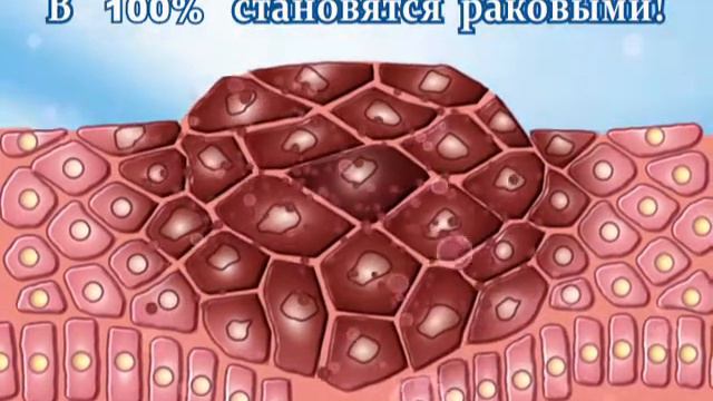 ВПЧ - вирус папилломы человека