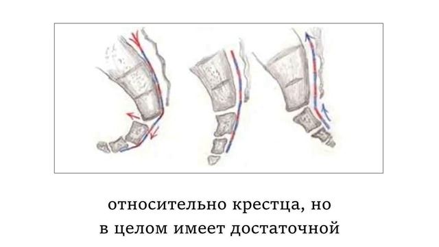 Ушиб крестца и головные боли (из опыта практикующего врача)
