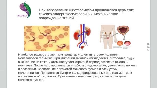 ***Паразит Шистосома***|***Parazit Shistosoma*** смотреть онлайн