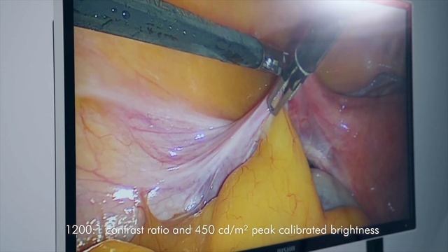 E550DG - 55" 4K Surgical Monitor (English) смотреть онлайн