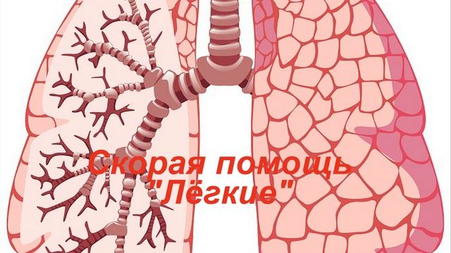 Скорая помощь Лёгкие смотреть онлайн