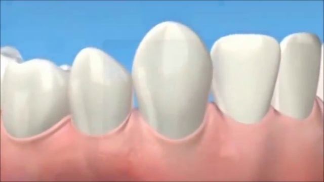 Introduction to Oral Irrigator смотреть онлайн