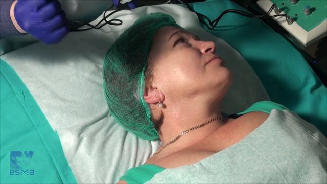 Микротоковая терапия на аппарате ЭСМА (часть 1 - комплексная терапия) смотреть онлайн