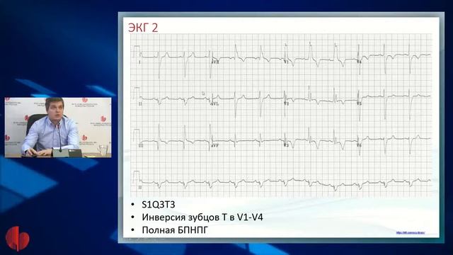 Тактика ведения кардиологических больных в реанимационном отделении. Часть 5