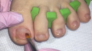 Жесть!?Наращивание Ногтей на Ногах. Педикюр пошагово. Наращивание ногтей без форм.