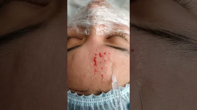 чёрные точки косметологические услуги смотреть онлайн