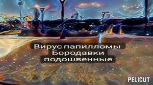 ?Матрица Гаряева .Вирус папилломы Бородавки подошвенные.