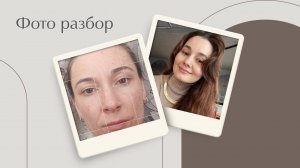 Асимметрия лица. Рубрика Фотовопрос.