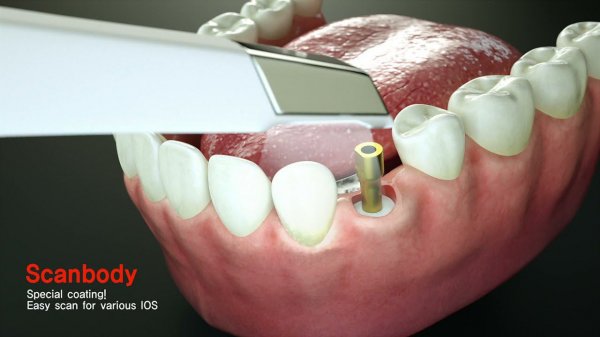 Dentis CAD/CAM Решения