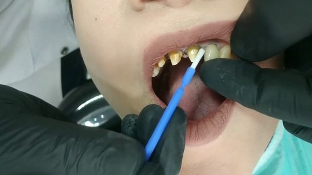 прескерамика смотреть онлайн