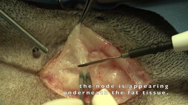 The inguinal lymph node resection in a male dog смотреть онлайн