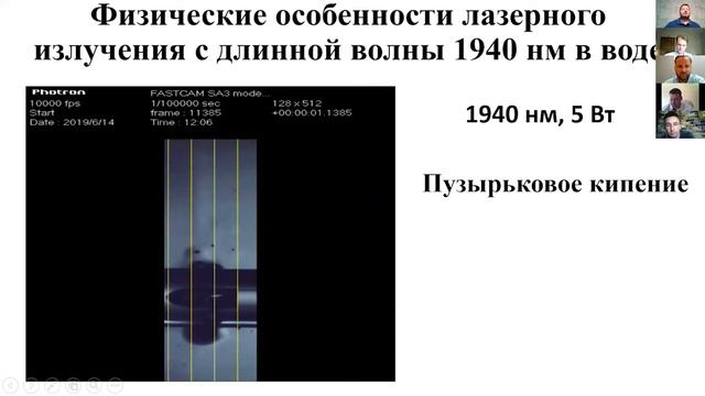 ЭВЛК 1940 нм - есть ли преимущества ? Капериз К. А. смотреть онлайн