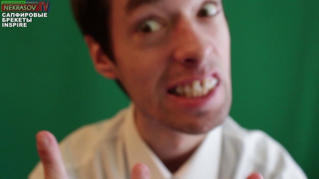 шоу презентация NEKRASOV TV 2013 сапфировые брекеты inspire смотреть онлайн