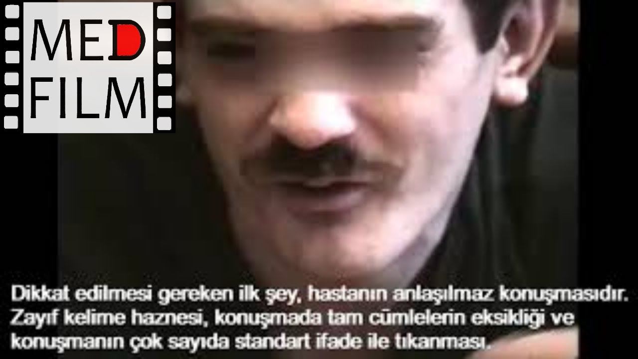 Олигофрения (турец. титры) © Zeka Geriliği | Oligofreni