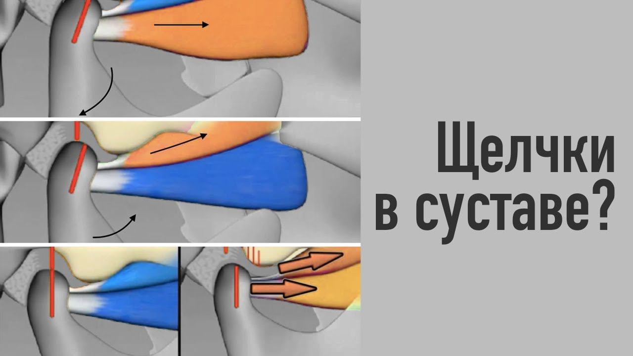 Щелчки в ВНЧС. Как они появляются и почему это не норма. смотреть онлайн