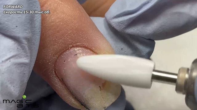 КЕРАМИЧЕСКАЯ ФРЕЗА КУКУРУЗА мягкого абразива смотреть онлайн
