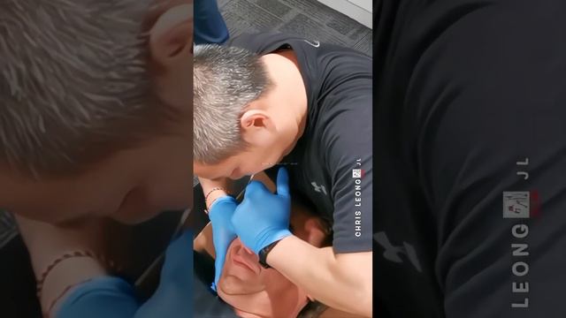 Этот мужчина повредил себе нос (Credit - @masterchrisleong on IG) #костоправ #мануальнаятерапия смотреть онлайн