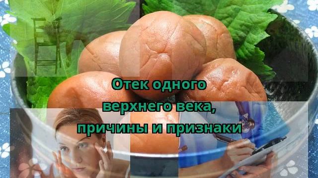 Отек одного верхнего века, причины и признаки смотреть онлайн