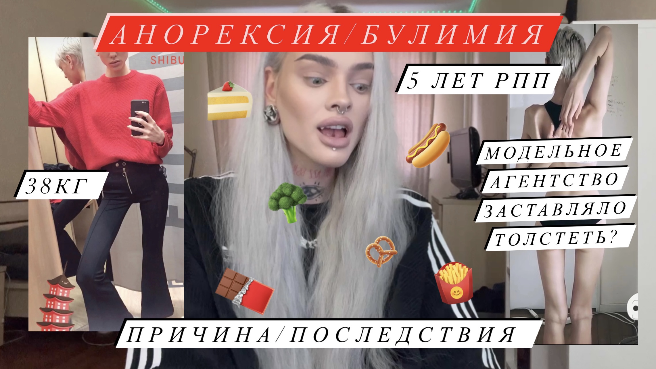 5 ЛЕТ РПП! Моя история: анорексия, булимия смотреть онлайн