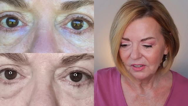 Home Wrinkle Treatment - Before & After Pics - NIRA Laser Over 50 смотреть онлайн