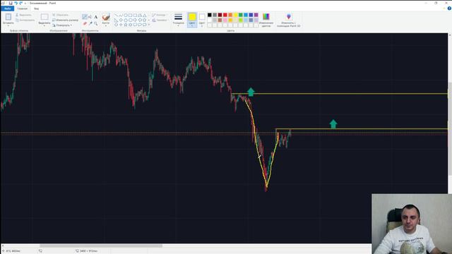 Консервативные ТВХ при ложных ПРОБОЯХ смотреть онлайн