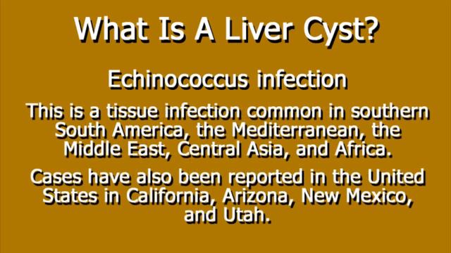 What Is A Liver Cyst?