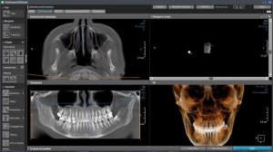 Горячие клавиши в OnDemand 3D Dental