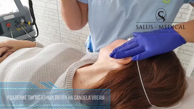 Лазер GentleLase Pro (Candela) смотреть онлайн