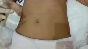 Как сделать подкожную инъекцию.