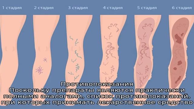 Что лучше — Венарус или Флебодиа? смотреть онлайн