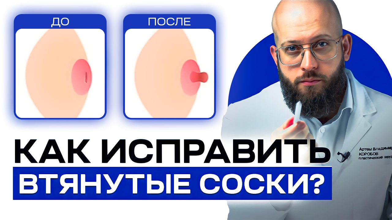 Проблема втянутых и плоских сосков смотреть онлайн
