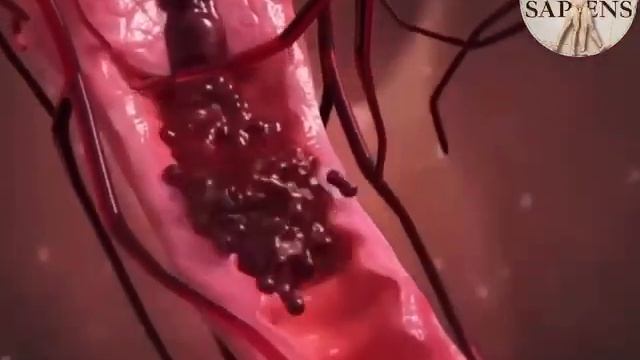 Менструация смотреть онлайн