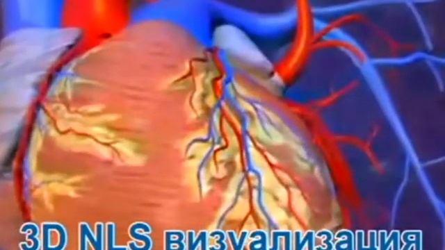Кардиологический центр диагностики и NLS лечения смотреть онлайн