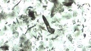 КЛЕЩИ ЖИВУЩИЕ НА ТЕЛЕ ЧЕЛОВЕКА/ПАРАЗИТЫ. ДЕМОДЕКС.[IN THE TREND]