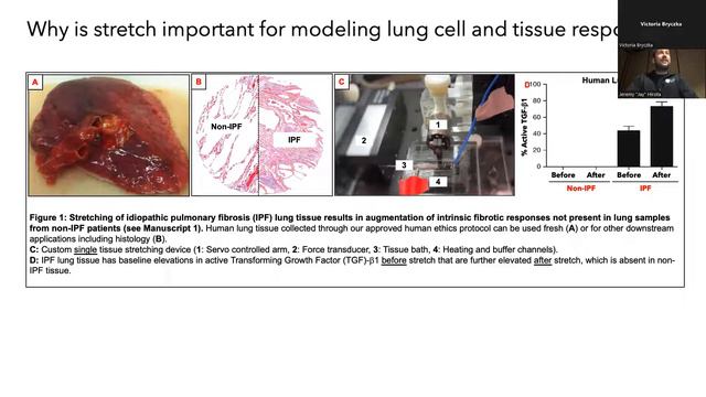 Regional Respirology Research Rounds - November 1, 2022 смотреть онлайн