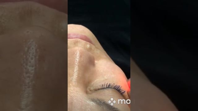 Rfлифтинг лица.Уфа, студия «Клементина» смотреть онлайн