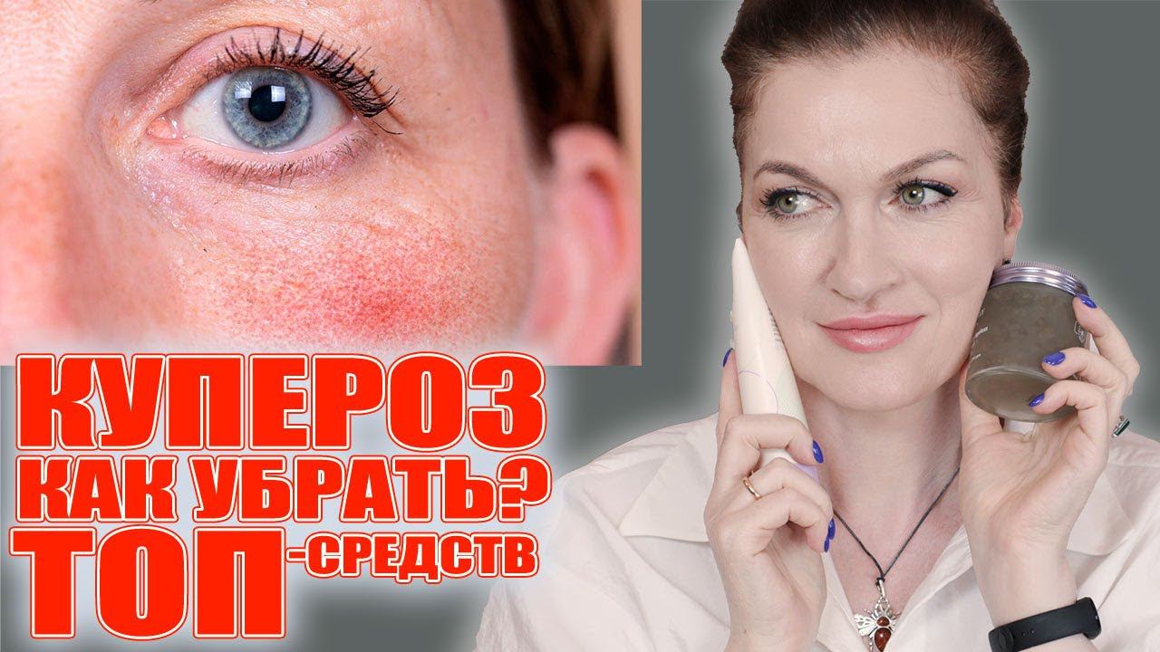 Полная система ухода против купероза! От очищения до ночной рутины. 100% результат! смотреть онлайн