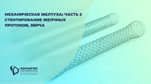 МЕХАНИЧЕСКАЯ ЖЕЛТУХА ЧАСТЬ 2 / СТЕНТИРОВАНИЕ ЖЕЛЧНЫХ ПРОТОКОВ / ЭНДОБИЛИАРНАЯ РАДИОЧАСТОТНАЯ АБЛЯЦИЯ