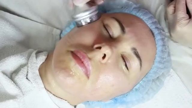 Урок. Радиочастотный лифтинг смотреть онлайн