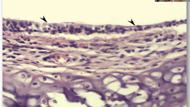 17. РЕАКЦИЯ ГЕТЕРОГЕННЫХ ОРГАНОВ НА ИНКОРПОРИРОВАНИЕ ОБЕДНЁННОГОУРАНА смотреть онлайн