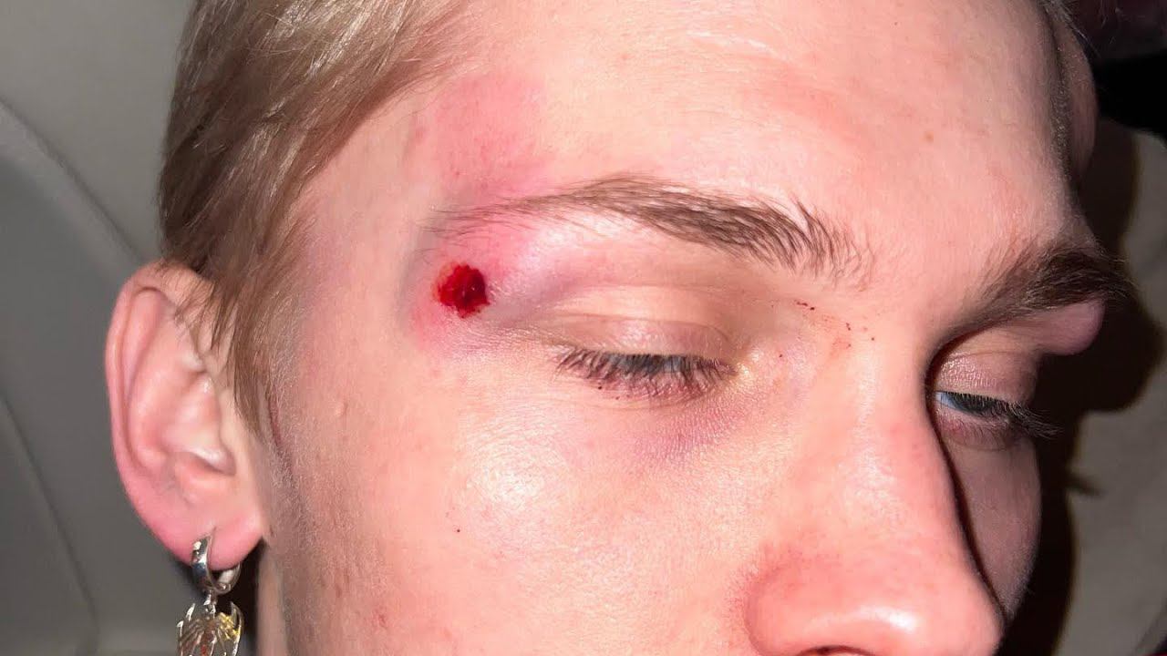 Как себя чувствует Даня Милохин?♀️ смотреть онлайн